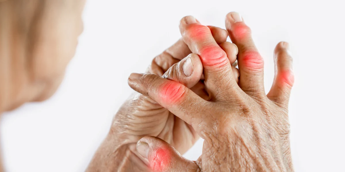 Why Almost All Older Adults Experience Arthritis