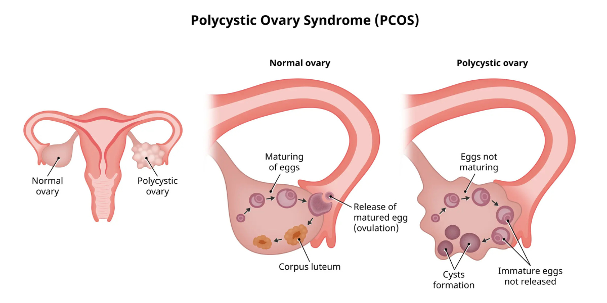 How to Use Turmeric Curcumin Capsules in Pain Relief